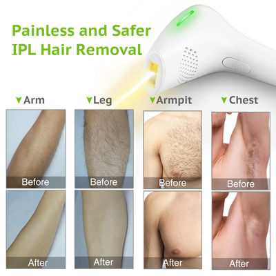 12V Home Laser Hair Removal Machine , 3A Hair Removal Laser Device