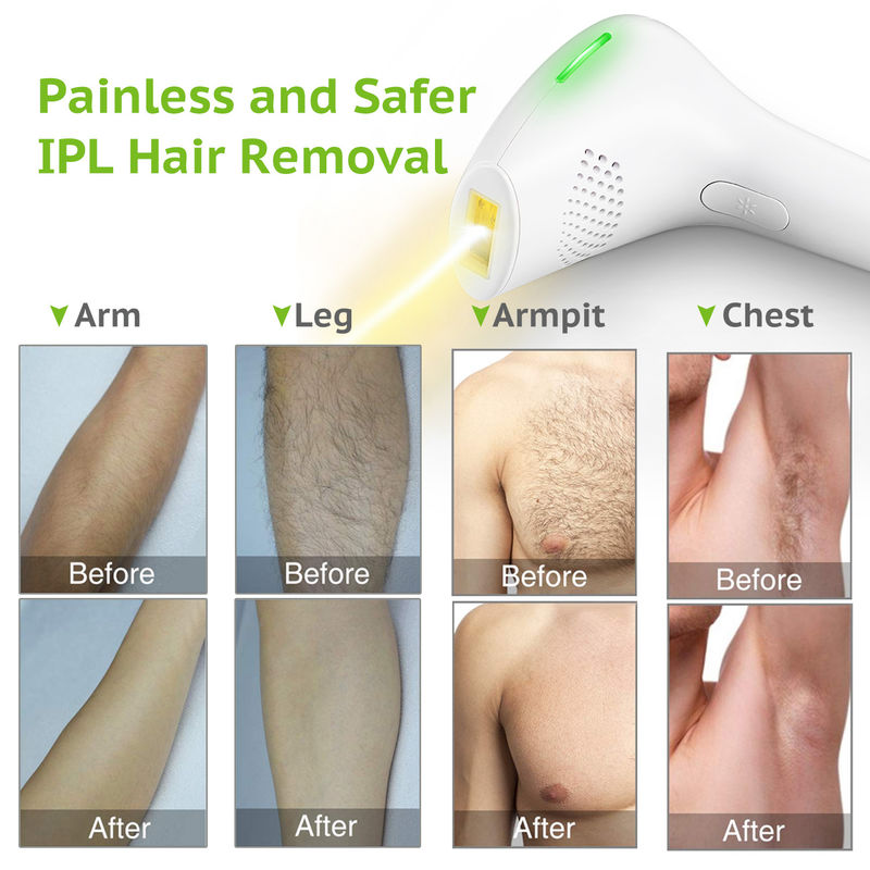 12V Home Laser Hair Removal Machine , 3A Hair Removal Laser Device